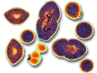 an image of an infection with the Vancomycin-Resistant Enterococcus bacteria